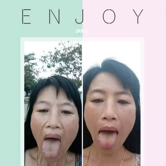 【案例分享】调理身体