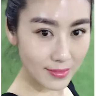 【净食案例】排毒、战痘、调理身心