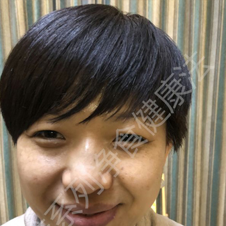 【净食案例】调理过敏性鼻炎、寒湿体质、增强抵抗力