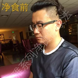 【净食案例】——减重、调理鼻窦炎、改善肤质