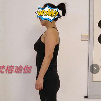 【净食案例】——调理内分泌、调理过敏性鼻炎