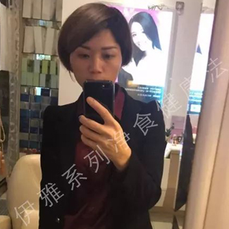 【净食案例】——改善手部的过敏、调理身体