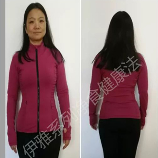 【净食案例】——调理、排毒、减肥 