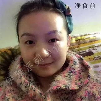 【净食案例】——调理妇科、缓解术后腰部疼痛