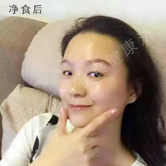 【净食案例】——调理妇科、缓解术后腰部疼痛