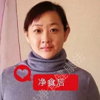 【净食案例】——调理亚健康、便秘、排毒！