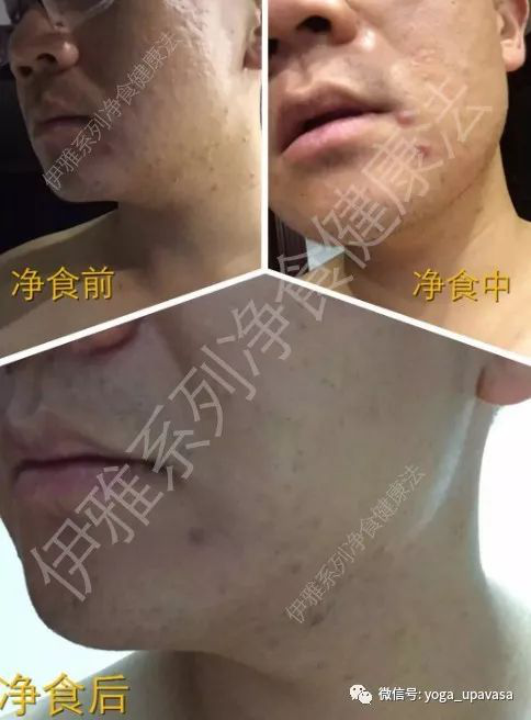 5def687d2b5c7.png 1.png